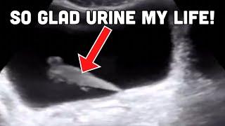 Why does the body make URINE? Doctor Explains!