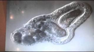 Amoeba eats two paramecia (Amoeba's lunch)