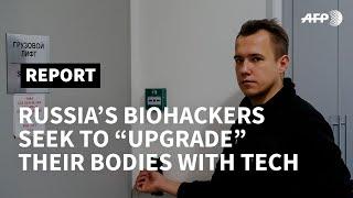 Russia: biohackers seek to "upgrade" their bodies with tech  | AFP