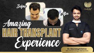 Amazing Hair Transplant Experience Ft. @kashishanand.9  | Best Hair transplant in Delhi  | MedLinks