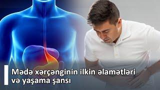 Mədə xərçənginin ilkin əlamətləri və yaşama şansı