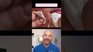 Derm reacts to JUICY pimple pop! #dermreacts #doctorreacts #pimplepop