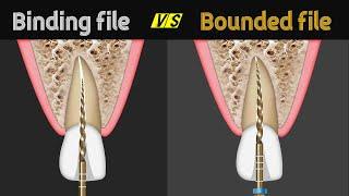 Binding file Vs Bounded file