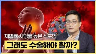 식도 전체를 잘라낸다고?! 식도암 수술 후유증과 관리법 - 삼성서울병원 폐식도외과 박성용 교수