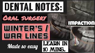 WINTER’S or WAR LINES || IMPACTION || ORAL SURGERY || DENTAL NOTES || STUDY WITH ME (made so easy)