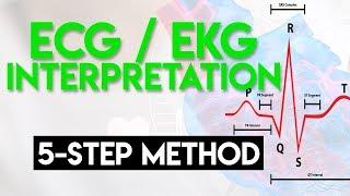 ECG Interpretation Made Easy | ECG EKG Interpretation (Part 2)