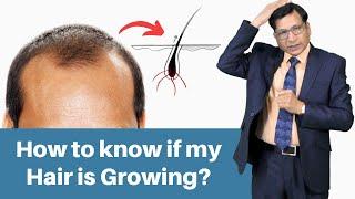 How I Can Know That My Hairs Are Growing? Dr. Anil Garg | Indore, Madhya Pradesh