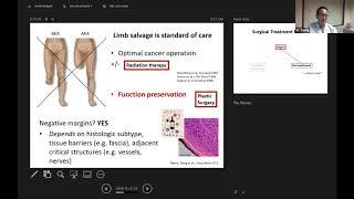 Sarcoma Exchange 2020 - Day 2