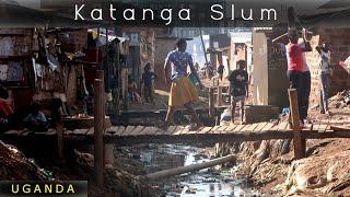 Katanga Slum, Uganda (When you see this . . .)