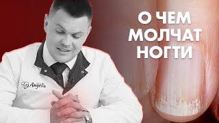 ОБРАТИ ВНИМАНИЕ НА СВОИ НОГТИ | Клиника Online