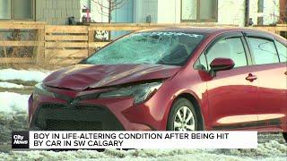 Boy in life-altering condition after being hit by car in SW Calgary