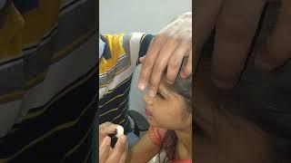 how to wear and remove of artificial eye. ખોટી આંખ કેવી રીતે કડવાણી અને નાખવાની