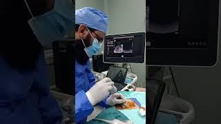 Ultrasound guided biopsy from hepatic Focal lesion. Dr. El Sayed Imam NHTMRI Cairo Egypt.