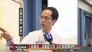 20150203 「病毒疣」與雞眼不同 存在病毒傳染性