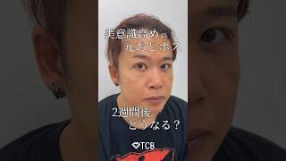 【クマ取り】美意識高めの元おじホス、2週間後どうなる？ #shorts