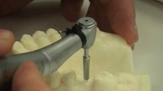 Dental implant surgery training video