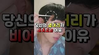 진짜 옆머리 안 비어보이는 방법 #m자탈모