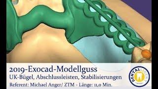 2019-EXOCAD - Tutorial Exocad Modellguss UK-Bügel, Abschlussleisten, Stabilisierungen