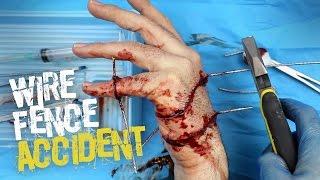 Wire fence accident SFX makeup tutorial