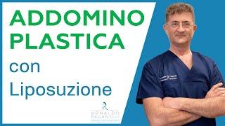 Addominoplastica con Liposuzione - Dr Arnaldo Paganelli Chirurgo Plastico