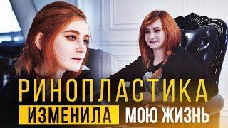 С этим невозможно смириться! Ринопластика. Откровенная история Юлии