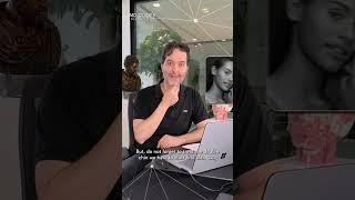 Double Chin only with Jw? - MD Codes Q&A Session