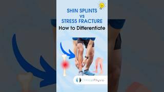 Shin Splints vs. Stress Fracture #physicaltherapy #physiotheraphy #shinsplints