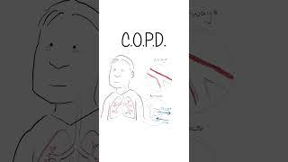 COPD - Explained #healthsketch #shorts