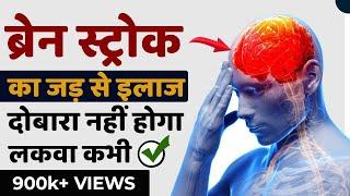 ब्रेन स्ट्रोक का जड़ से इलाज | दोबारा नहीं होगा लकवा कभी | Brain Stroke Treatment | Lakwa Ka Ilaj