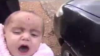 СИРИЯ. Раненный осколком в голову ребенок.