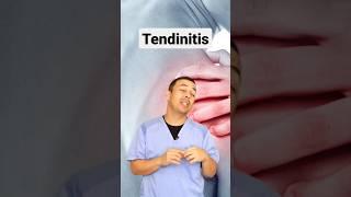 Tendinitis, por eso no te recuperas  #hombro #dolor #tendinitis #fisioterapia #terapia