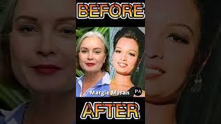 FILIPINO ARTIST 70S TO 2023 #shorts #showbiz #beforeandafter