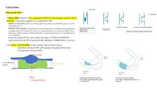 NSTEMI angiographic and PCI tips