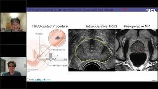 Machine Learning in Ultrasound Guided Surgery and Intervention - Webinar by RSIP Vision / Yipeng Hu