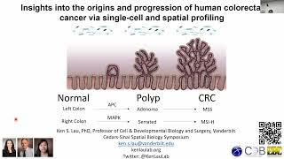 Ken Lau: The origins and progression of human colorectal cancer