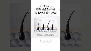 미녹시딜 고민 중이라면 꼭 알아야 하는 사실
