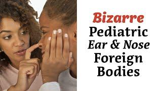 Bizarre Pediatric Ear and Nose Foreign Bodies