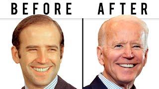 Joe Biden's NEW FACE | Plastic Surgery Analysis