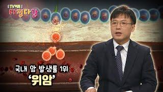 ‘의학 알지’ 위암 / KBS대전 20210415 방송