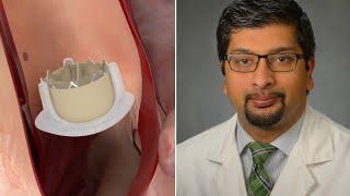 Heart Valve Re-Operations: What Should Patients Know? (with Dr. Nimesh Desai)
