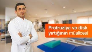 Protruziya və disk yırtığının müalicəsi