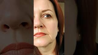 Почему после булхорна могут усилиться носогубные складки? / Грецкова Евгения Евгеньевна