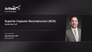 Superior Capsular Reconstruction (SCR) Under the Cuff