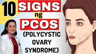 10 Signs ng PCOS (Polycystic Ovary Syndrome) - By Doc Liza Ramoso-Ong #1484