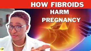 MUST WATCH - Trying To Conceive With Fibroids | Don't Ignore!