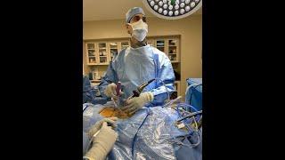 Dual Portal Endoscopic Spine Surgery | Nima Salari, MD