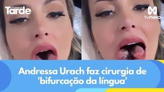 Andressa Urach faz cirurgia de 'bifurcação da língua'