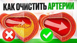 ЛУЧШИЕ продукты для очищения сосудов от бляшек. Добавьте их в свой рацион!