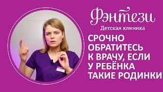 Срочно обратитесь к врачу, если у вашего ребёнка такие родинки 