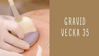 Gravid vecka 35